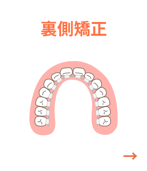 裏側矯正